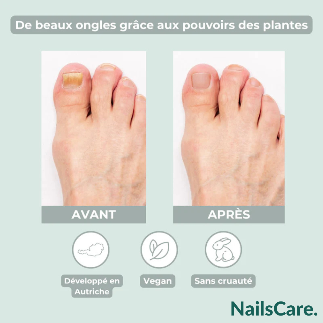 '+Nails Care pen-ap