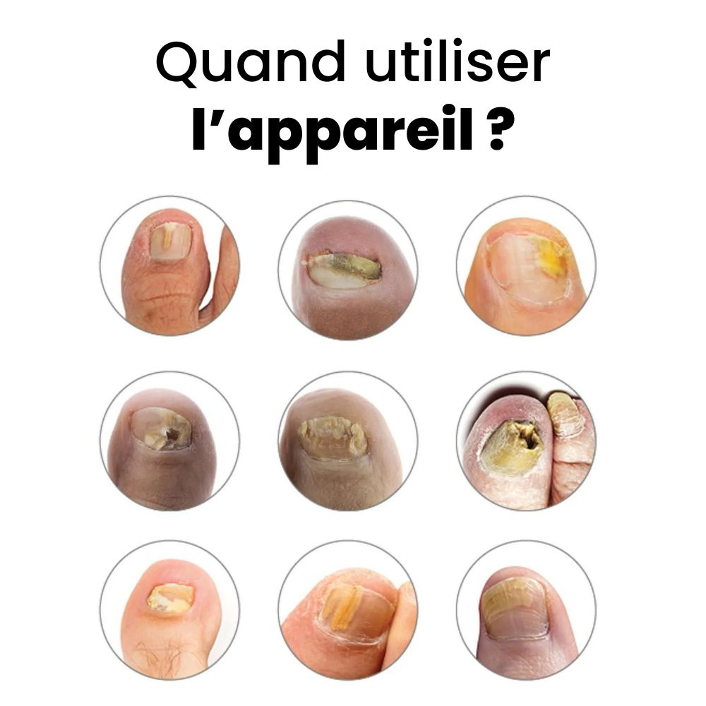 1x Appareil PRINCIPAL
